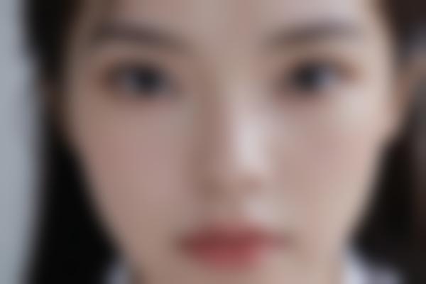 {激光怎么样？了解这些再决定是否要做