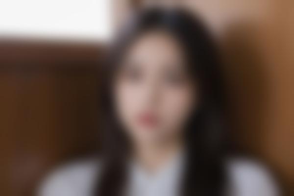 激光会疼吗？期要多久？
