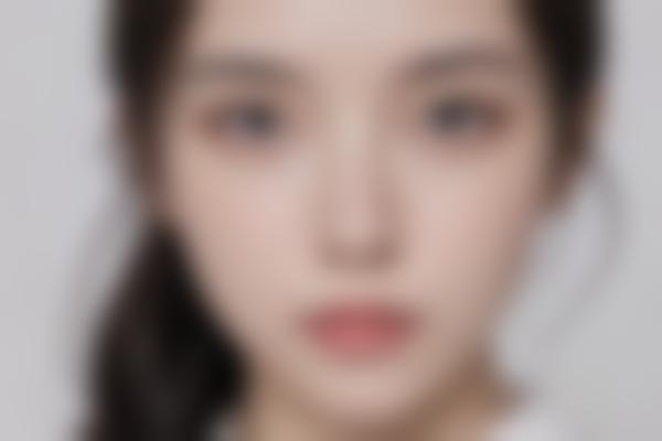 广州皮肤健康管理价格清单2024版，基础护理88元+/光子嫩肤680元+