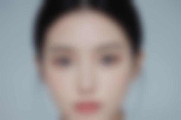 激光后怎么护理？