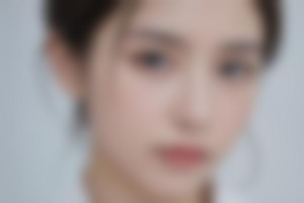 梅州整形医院哪家好？探访梅州皇佳贝丽医学美容门诊部的实力与特色