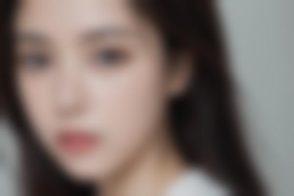 开内眼角手术明显吗？医生详解适应人群和术后注意事项