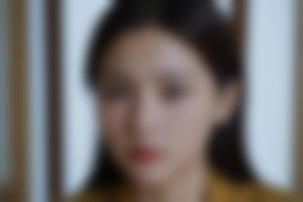 2024年遗传性皮肤病新科普：症状、治疗及费用全解析