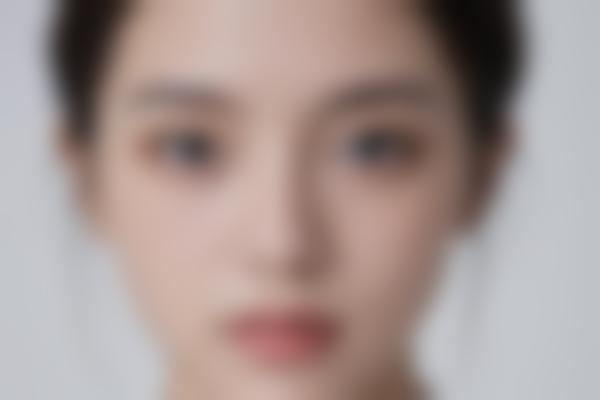 过敏性皮肤病变怎么办？3个护理要点帮你摆脱红肿瘙痒