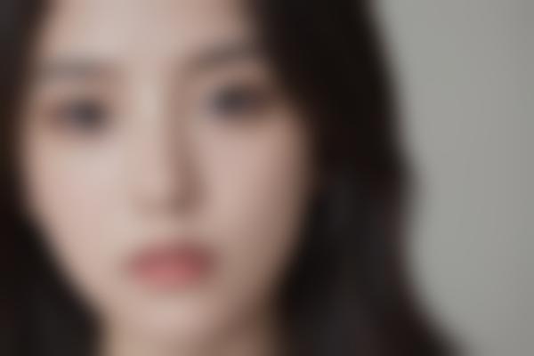 苏州美莱张亮医生：20年专注眼鼻整形与脂肪填充的医师解析