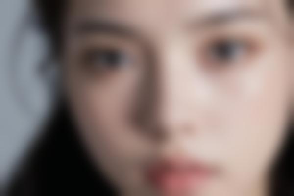 手臂整形价格一般多少钱？手臂吸脂和紧致手术的真实费用