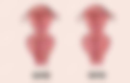 眼袋和眼睑是一个部位吗？权威解析两者区别并附对应部位特征图片 