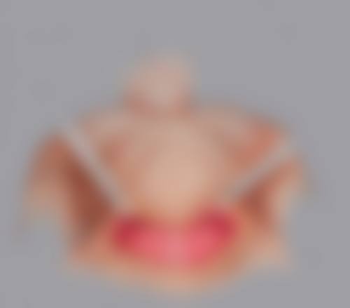 六、小腿有手术疤痕可以当兵吗？实例分析