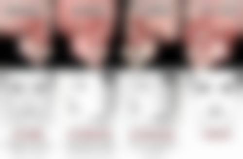 四、有骨膜贴片隆鼻吗？骨膜贴片隆鼻的成效呈现