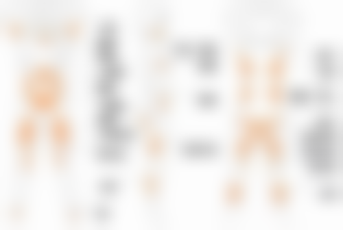 六、有骨膜贴片隆鼻吗？骨膜贴片隆鼻的修复情况