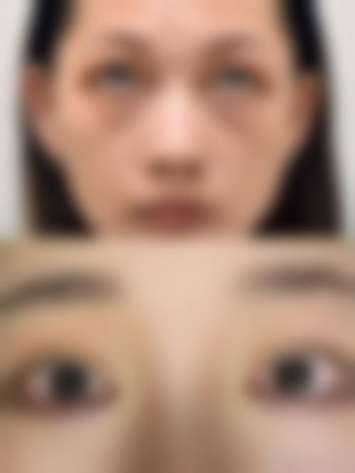 九、延吉韩龙云整形医学美容诊所真实的患者评价