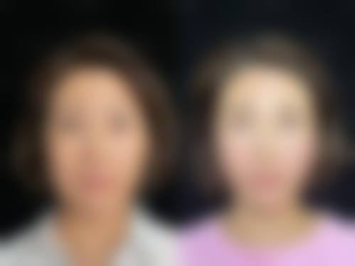 四、郑州蜜桃丰胸整形医院特色项目