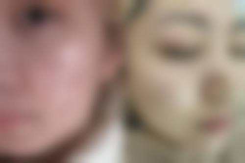 九、北京溪峰聚美仕整形美容真实的患者评价