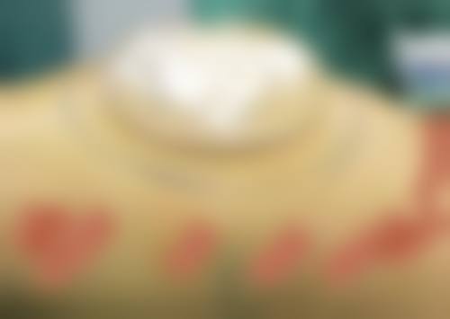 七、济南星达整形医院预约方式