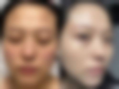 六、广州艾唯医疗美容医院价格表