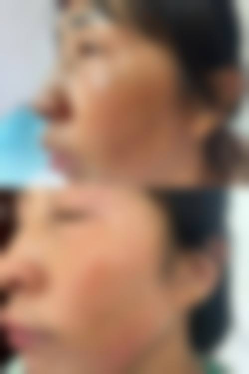 三、广州瓷肌整形医疗美容医院诊疗项目有哪些？