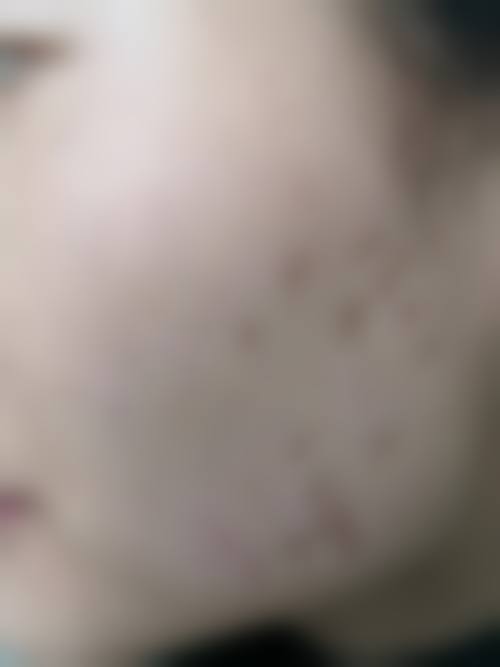 八、深圳伊婉门诊部预约方式