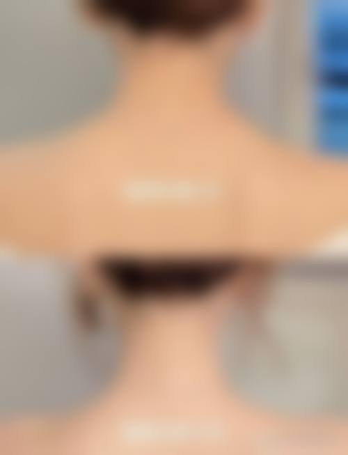 四、上海美尔雅医疗整形美容医院特色项目