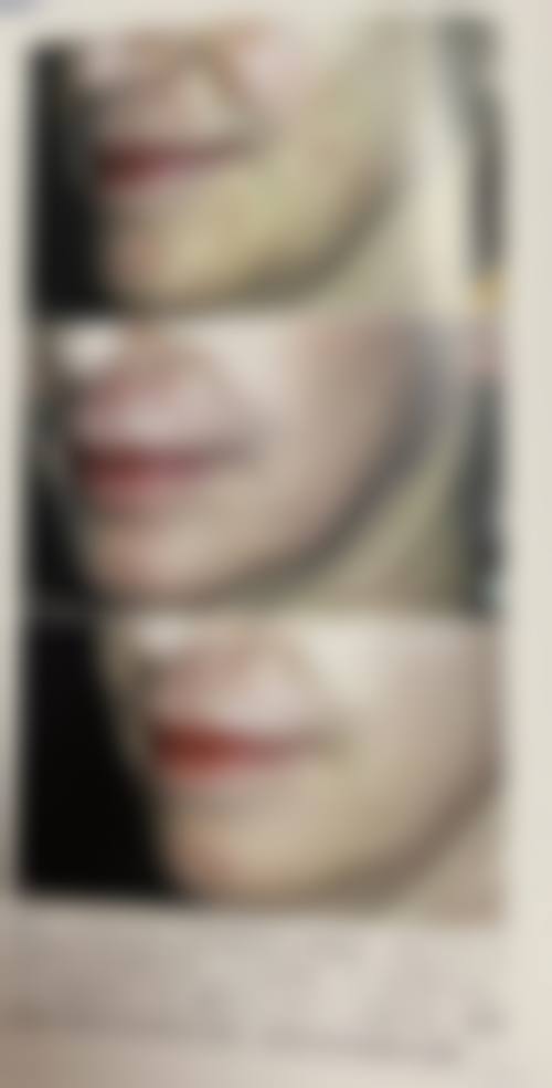 八、郑州蜜桃丰胸整形医院预约方式