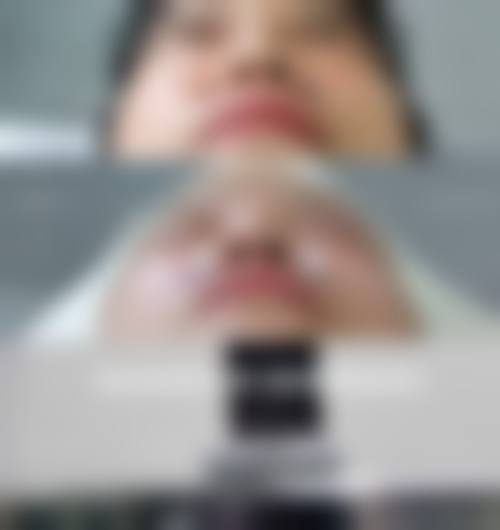 二、郑州蜜桃丰胸整形医院怎么样？