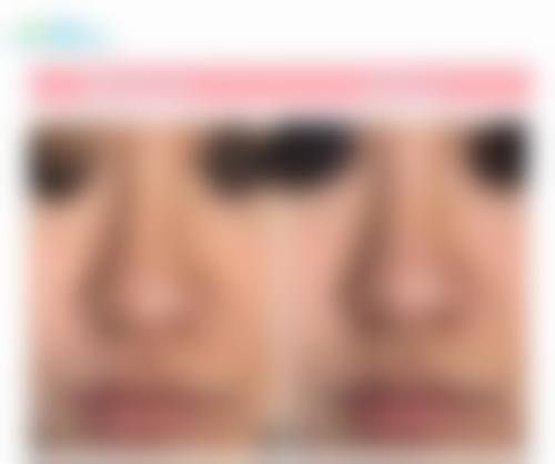 二、北京溪峰聚美仕整形美容怎么样？