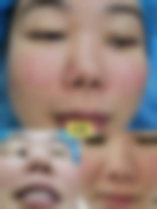 四、深圳伊婉门诊部特色项目