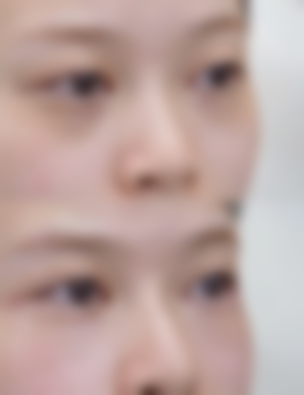 八、沈阳市鹏丽医疗美容诊所真实的患者评价