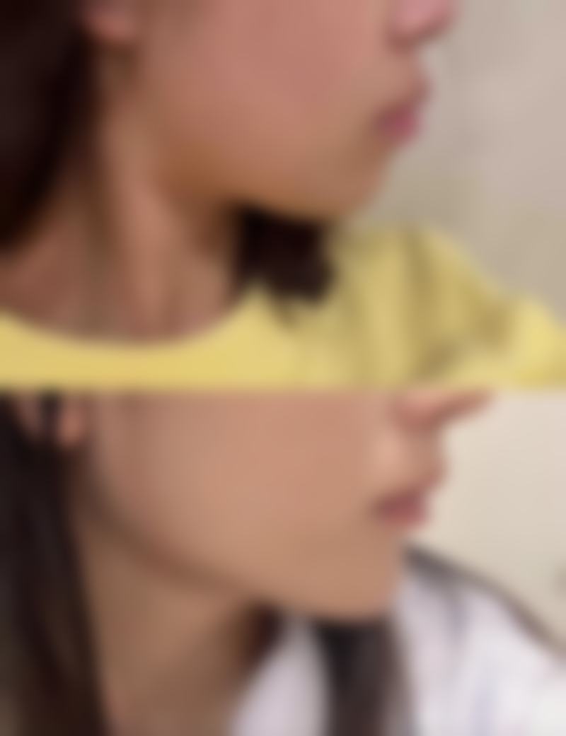 三、其他护理细节