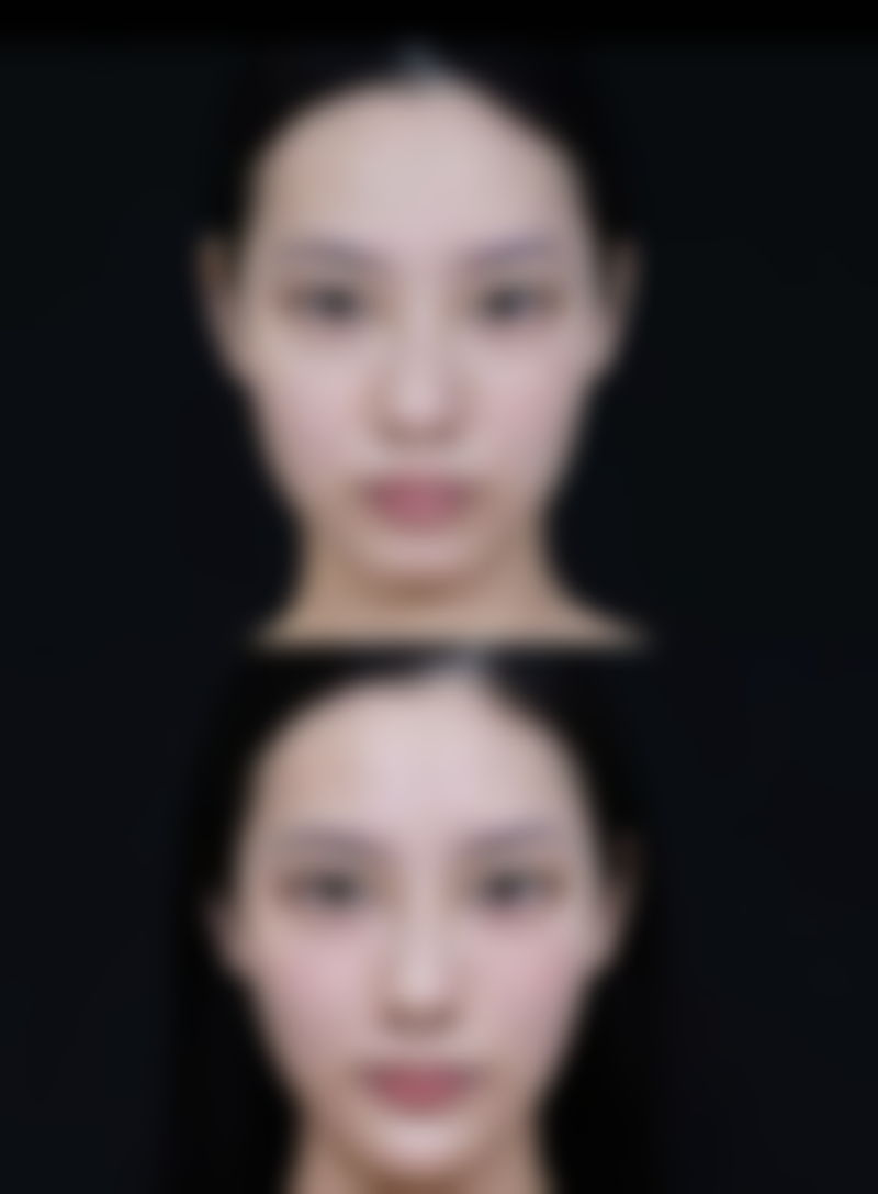 八、结尾：眼袋和眼睑是一个部位吗？