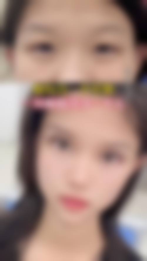 五、宜春丰城徐赵庆整形医疗美容诊所价格表