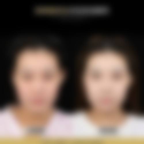 九、广州安丽维铂金整形医院真实的患者评价