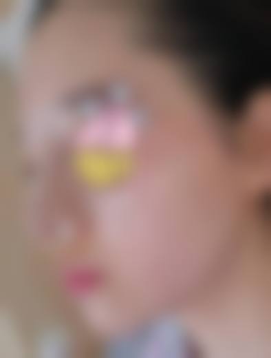 二、广州安丽维铂金整形医院怎么样？