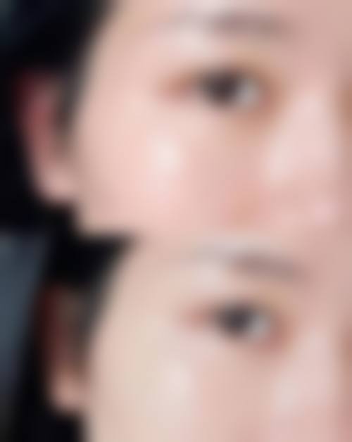 七、常州伊美尔医疗美容医院真实的患者评价