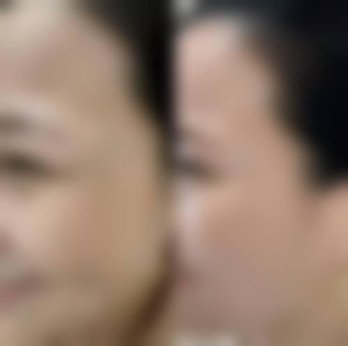 八、宜春丰城徐赵庆整形医疗美容诊所真实的患者评价