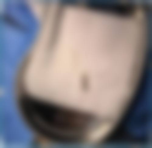 七、深圳星秀医疗美容门诊部预约方式