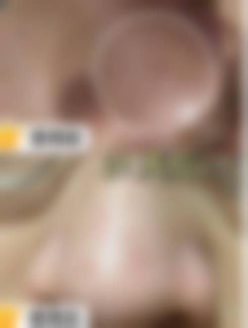 八、深圳星秀医疗美容门诊部真实的患者评价