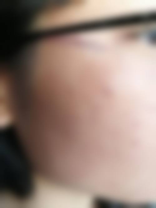 五、溧阳市人民医院烧伤整形科医生介绍