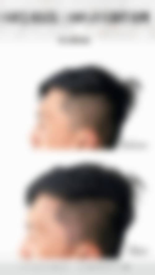 五、珠海得美整形医院价格表