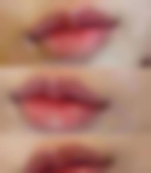 六、金华钰马整形医院价格表