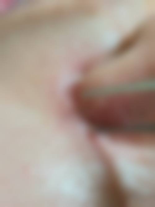 二、宜春丰城徐赵庆整形医疗美容诊所怎么样？