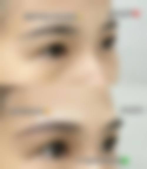 八、广州安丽维铂金整形医院预约方式