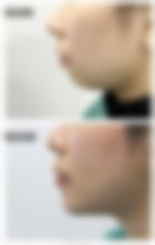 四、广州安丽维铂金整形医院特色项目