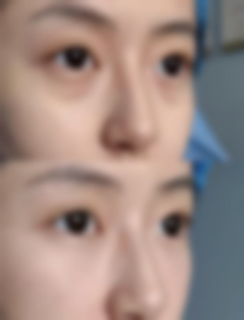 六、汝州臻美整形医院价格表