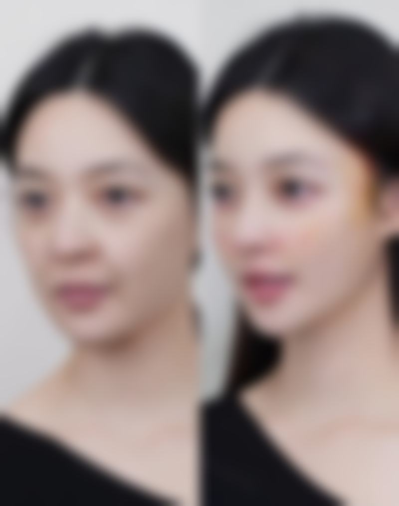 二、化妆品去眼袋的局限性