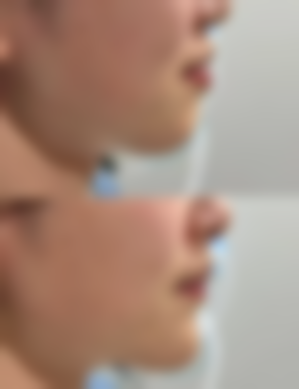 五、武警湖北总队医院整形美容科价格表