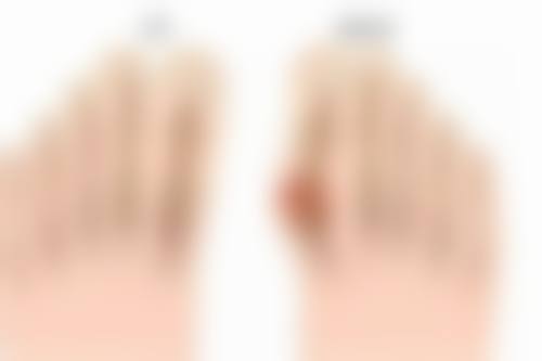 二、哪双眼皮修复做的好——国内有医生院推荐