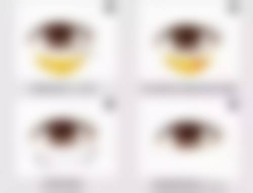 哪双眼皮修复做的好——总结