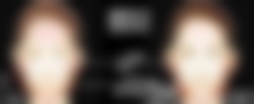 三、做了阴道修复多久能同房：注意事项与风险提示