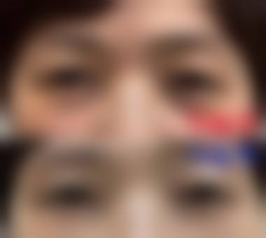 二、北京军区总医院美容整形医院怎么样？