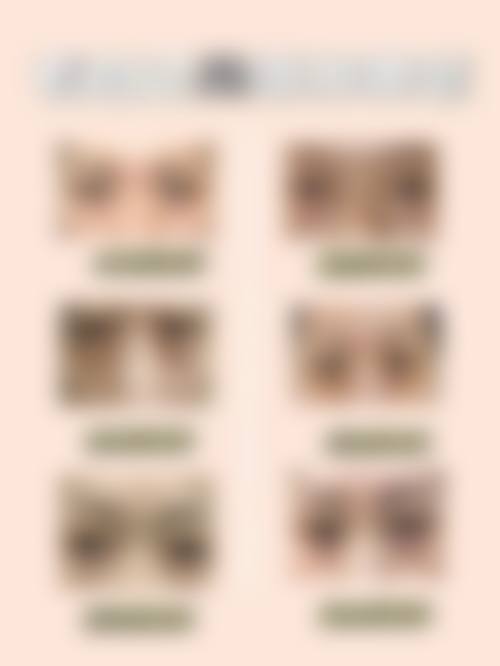 四、吉林卓研医疗美容门诊部特色项目